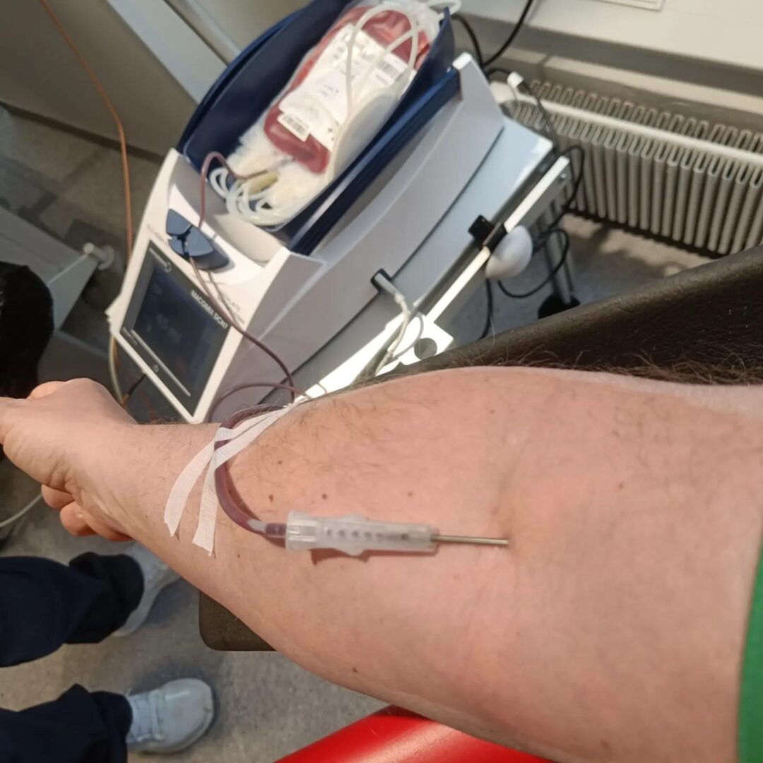 Käsi verenluovutuksessa. 